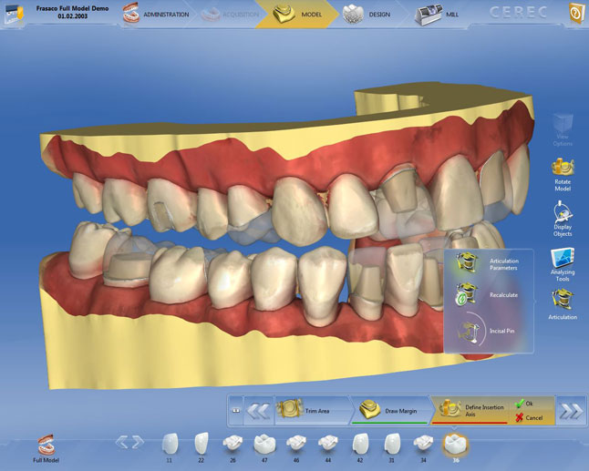 CEREC 통합 디지털 워크플로우