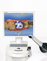 CAD/CAM 사진